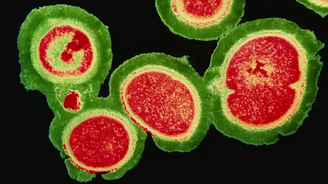 Бактерії