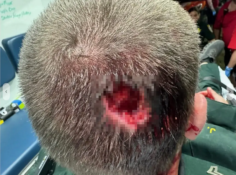 florida-deputy-recovering-attacked-vortex-81550429.png